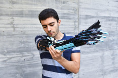 'Hand Solo': the one-armed boy who built a Lego prosthesis
