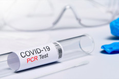 Easing but still cautious: The announcement from the Indonesian government about no more PCR testing for international travelers has been welcomed warmly by many. However, despite the ease of travel regulations, people still need to implement health protocols. (Pexels/Printexstar)
