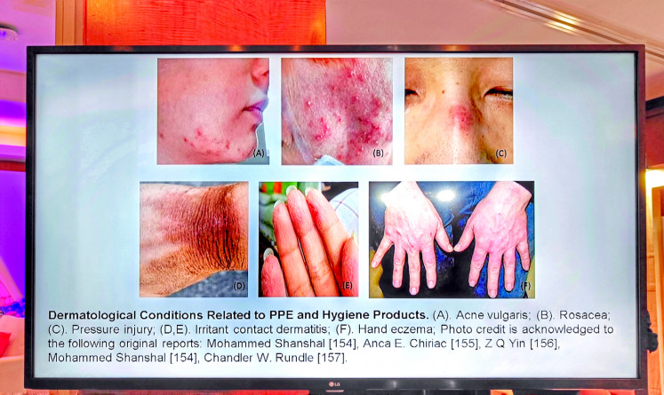 Side effects: One of the slides of Danang Triwahyudi's presentation depicts skin problems caused by the use of personal protective equipment (PPE) as preventive measures against COVID-19. (JP/Sylviana Hamdani) 