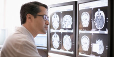 A health worker reads a brain scan in this handout photo. 