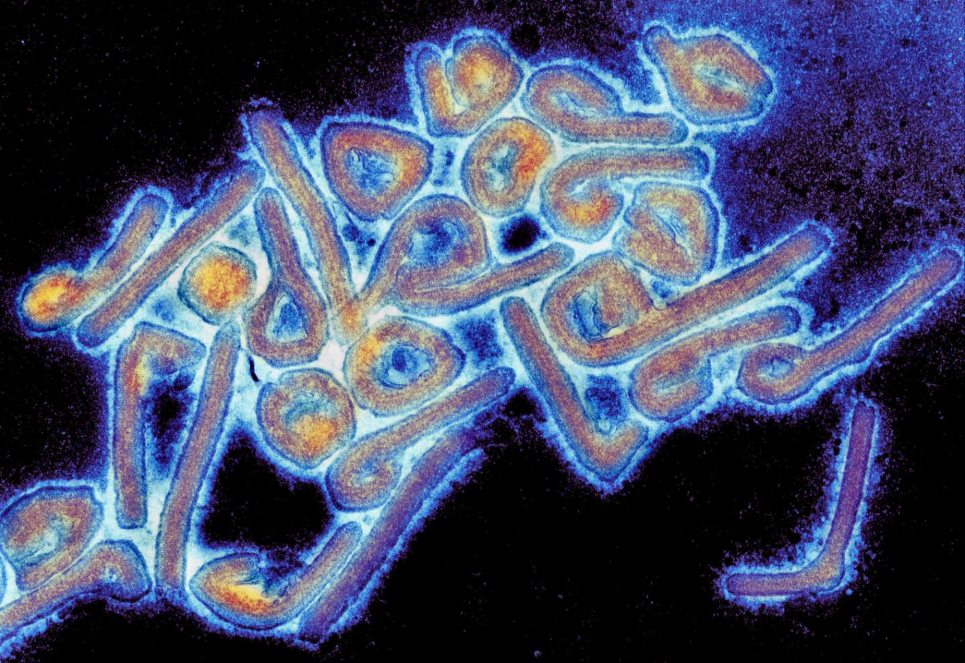 Indonesia on alert amid increase of Marburg virus disease outbreak