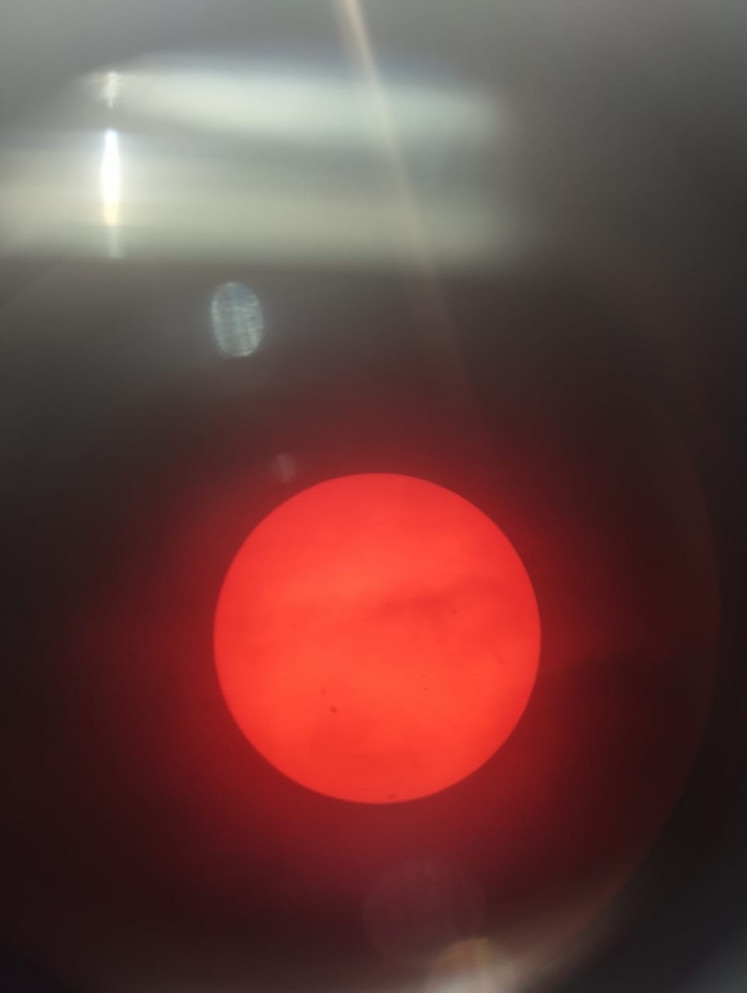 The sun appears orange with some sunspots as seen from a telescope installed at Taman Ismail Marzuki in Central Jakarta on March 1, 2024. 