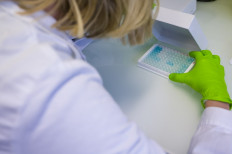A researcher looks at the reaction of biological samples for a clinical study at Inotrem's laboratory in Vandoeuvre-les-Nancy, eastern France, on Feb. 08, 2021.