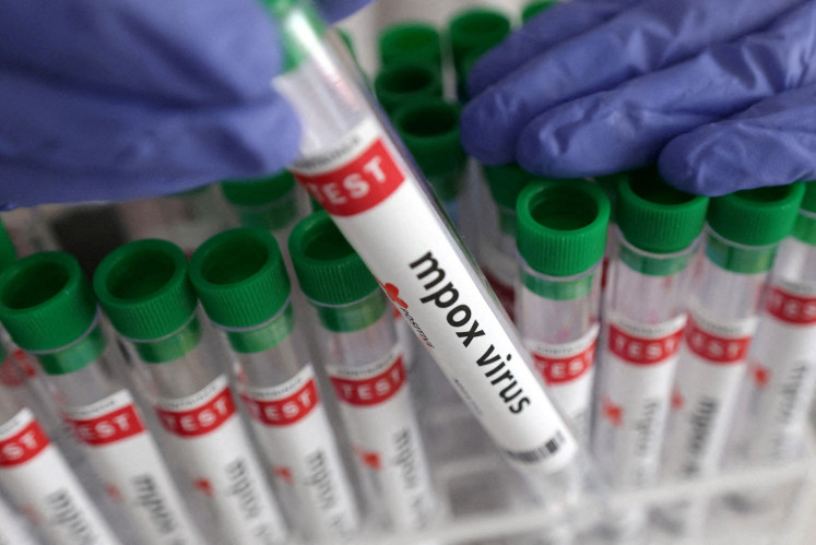 A test tube labeled “mpox virus“ is held in this illustration photo taken on Aug. 20, 2024. 