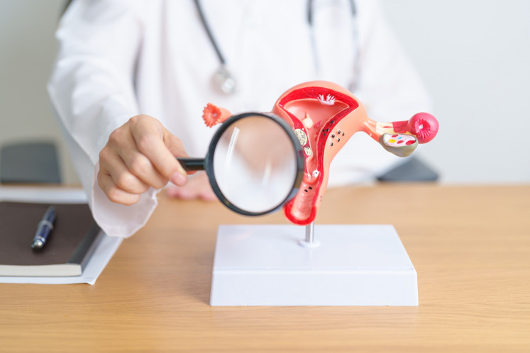 Illustraton of cervical cancer screening.