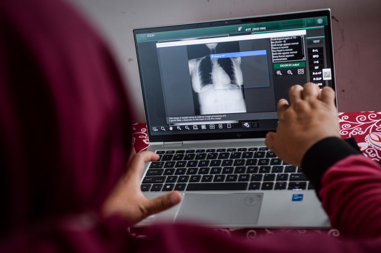 A health worker examines a resident’s chest X-ray on Nov. 11, 2025, at the Cibodasari Puskesmas (community health center) in Tangerang, Banten. 