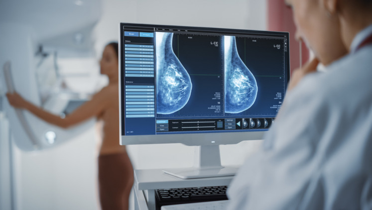 An illustration of a mammography examination on a breast to screen and diagnose illnesses such as cancer