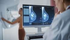 An illustration of a mammography examination on a breast to screen and diagnose illnesses such as cancer