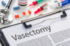 Stock illustration of vasectomy.